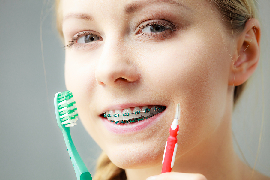 From Braces to Beautiful Smile: How Long Do You Really Need a Retainer?