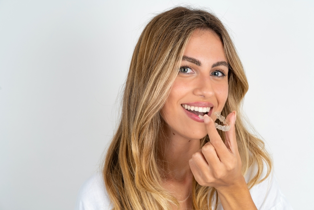 Invisalign Guide – Everything You Need to Know